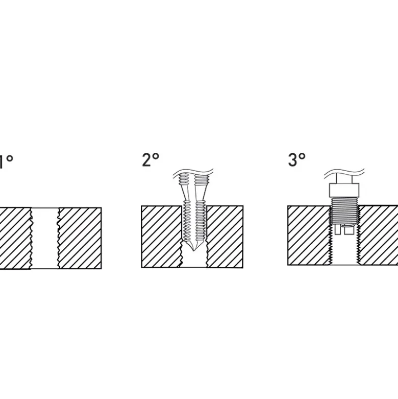 KIT RIPARAZIONE FILETTI METRICI CANDELE F-COIL